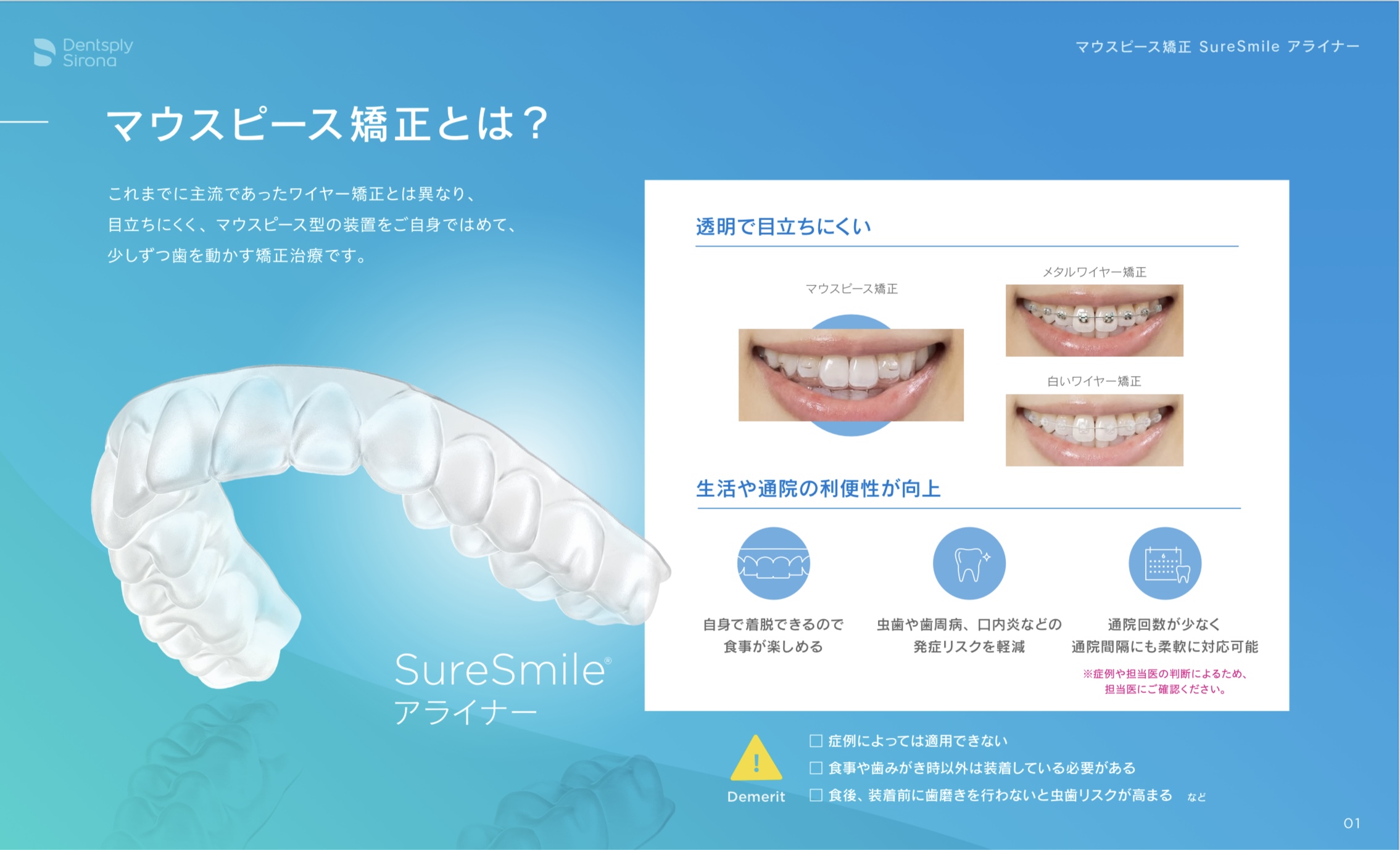 マウスピース矯正とは？